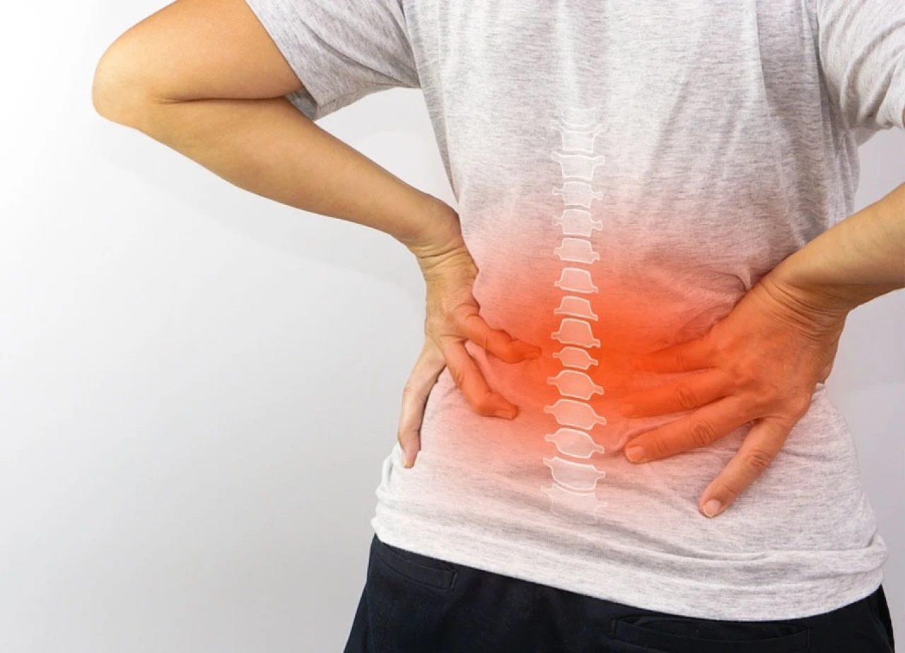 Bel Ağrısını Hafife Almayın: Bel Kayması (Spondilolistezis) Felç Riskine Yol Açabilir Mi?