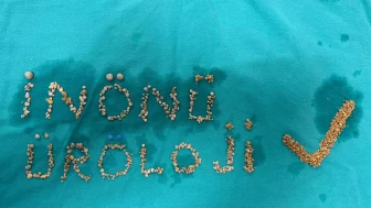 Ameliyattan hatıra: çıkan taşlarla imza attılar