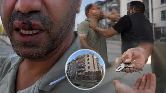 Malatya'da Şok İddia: Hak Sahibi Darp Edildi