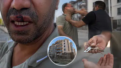 Malatya'da Şok İddia: Hak Sahibi Darp Edildi