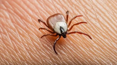 Kene Isırıklarına Dikkak: Yanlış Müdahale Risk Oluşturuyor