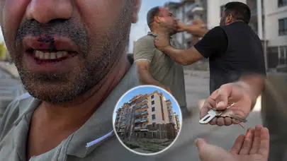 Malatya'da Şok İddia: Hak Sahibi Darp Edildi