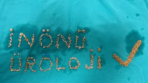 Ameliyattan hatıra: çıkan taşlarla imza attılar