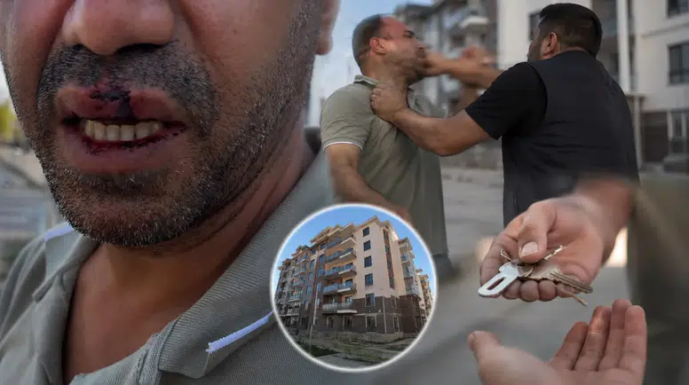 Malatya'da Şok İddia: Hak Sahibi Darp Edildi