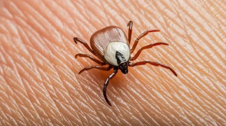 Kene Isırıklarına Dikkak: Yanlış Müdahale Risk Oluşturuyor